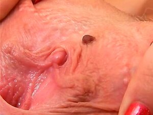 Variabilität der Schamlippen (Labien) Anatomie der Vulva Die Vulva hat  verschiedene Anteile: die äusseren und die inneren Sch